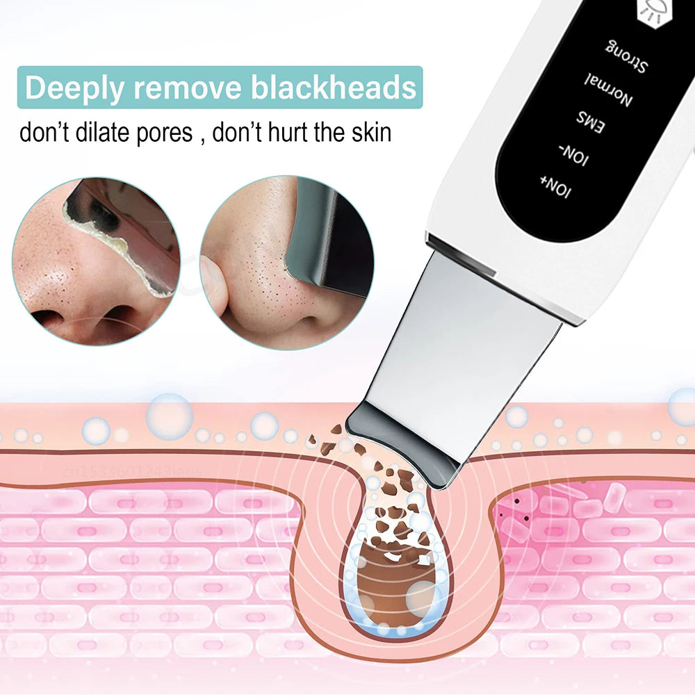 Ultrasonic Skin Scrubber Blackhead & Ance Pore Cleaner